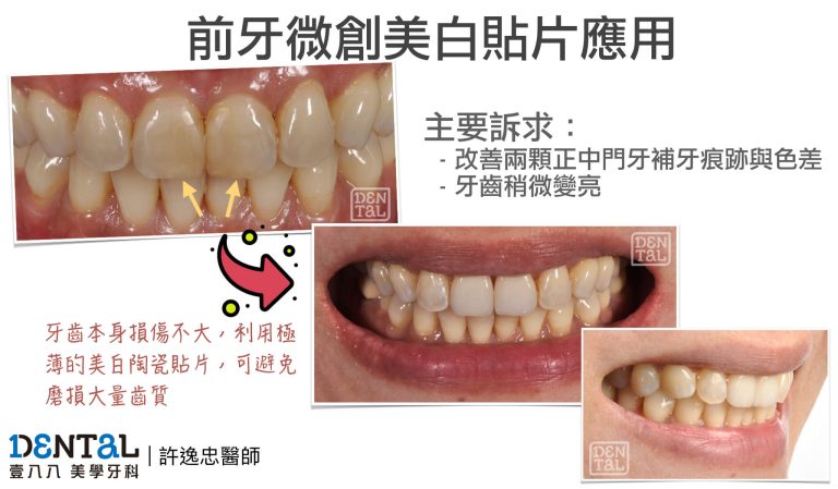 見證案例03
