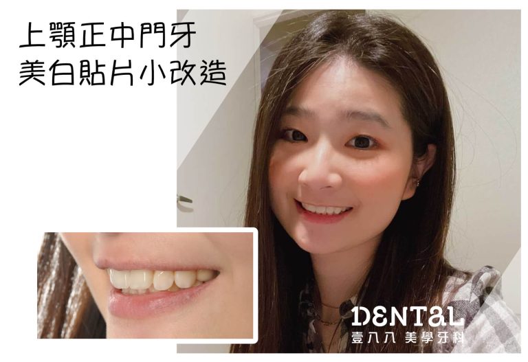 見證案例05
