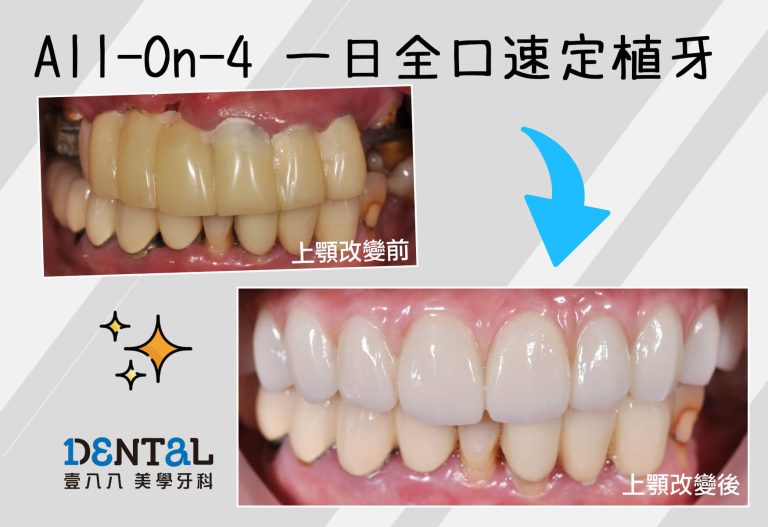 見證案例06