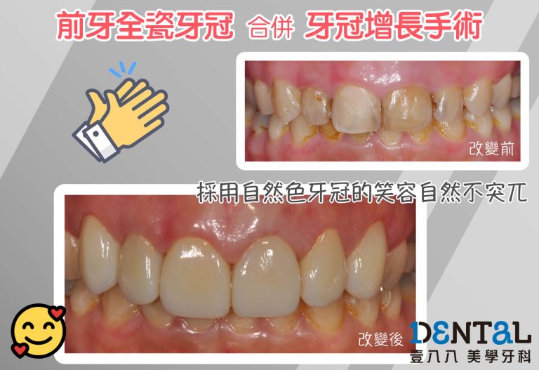 見證案例08