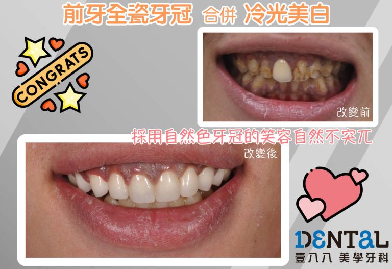 見證案例09