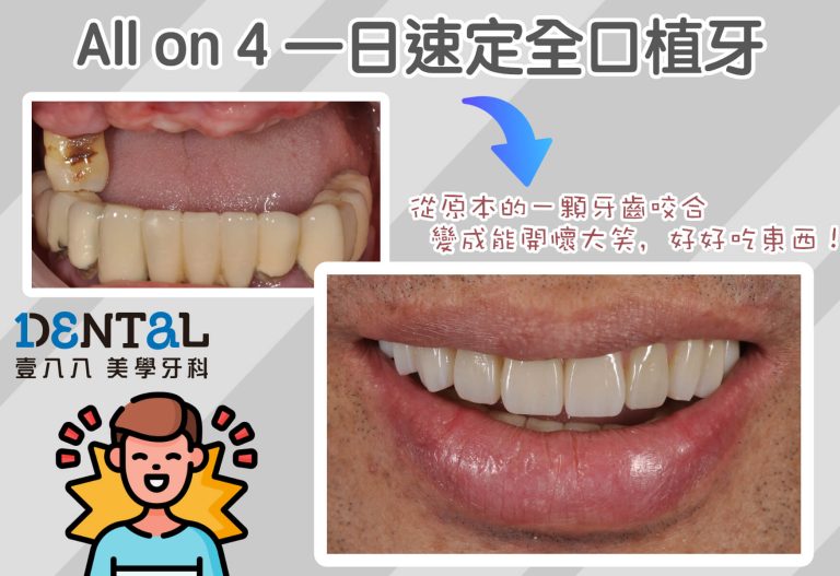 見證案例10