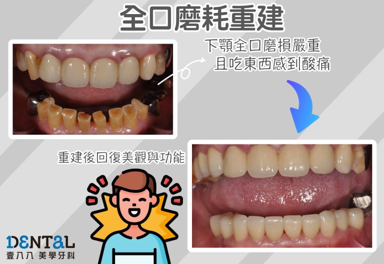 見證案例11