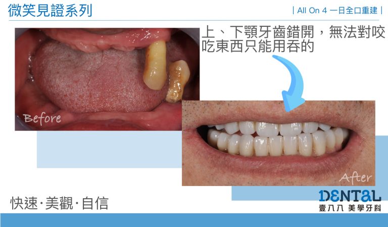 見證案例14
