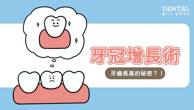 牙冠增長術封面