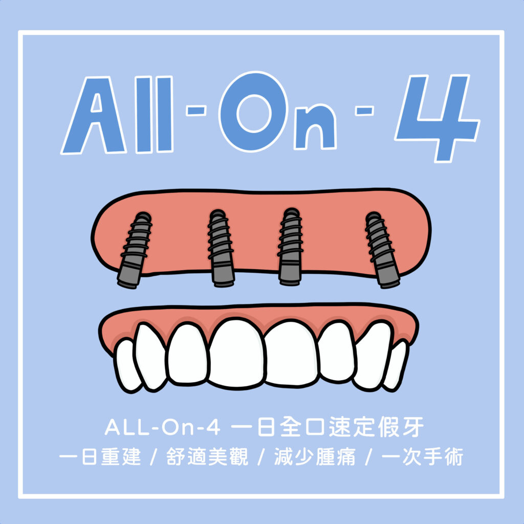 IG-allon4_01