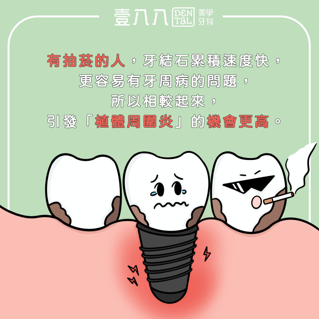 抽菸增加牙結石-1