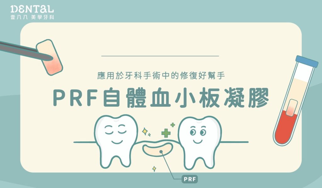 牙科PRF