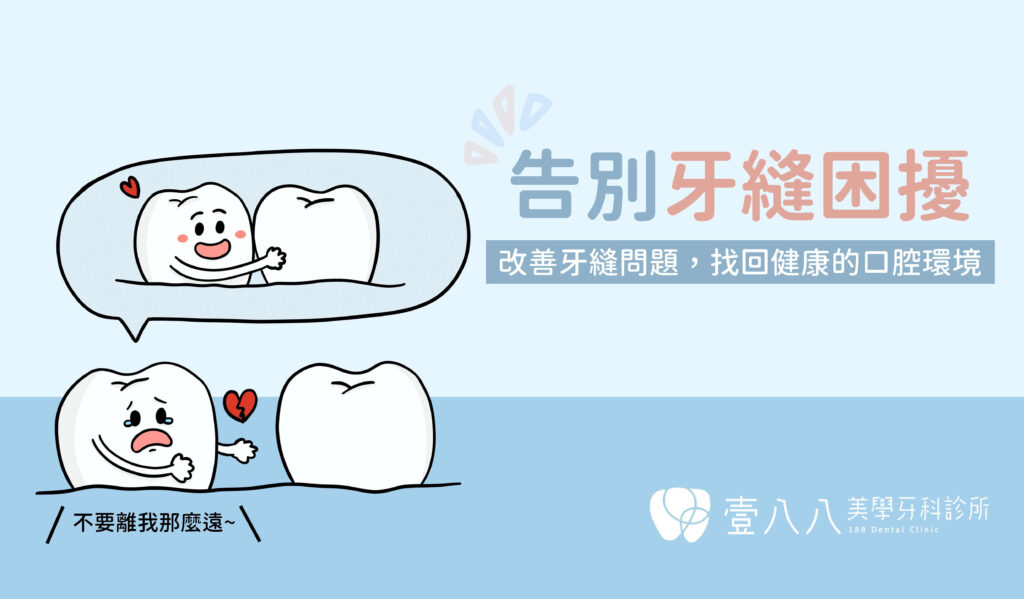 解決牙縫過大的三種療程