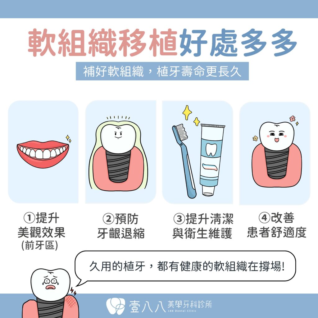 軟組織移植的好處多多