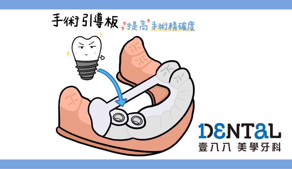 手術引導版3d列印用 1024x595