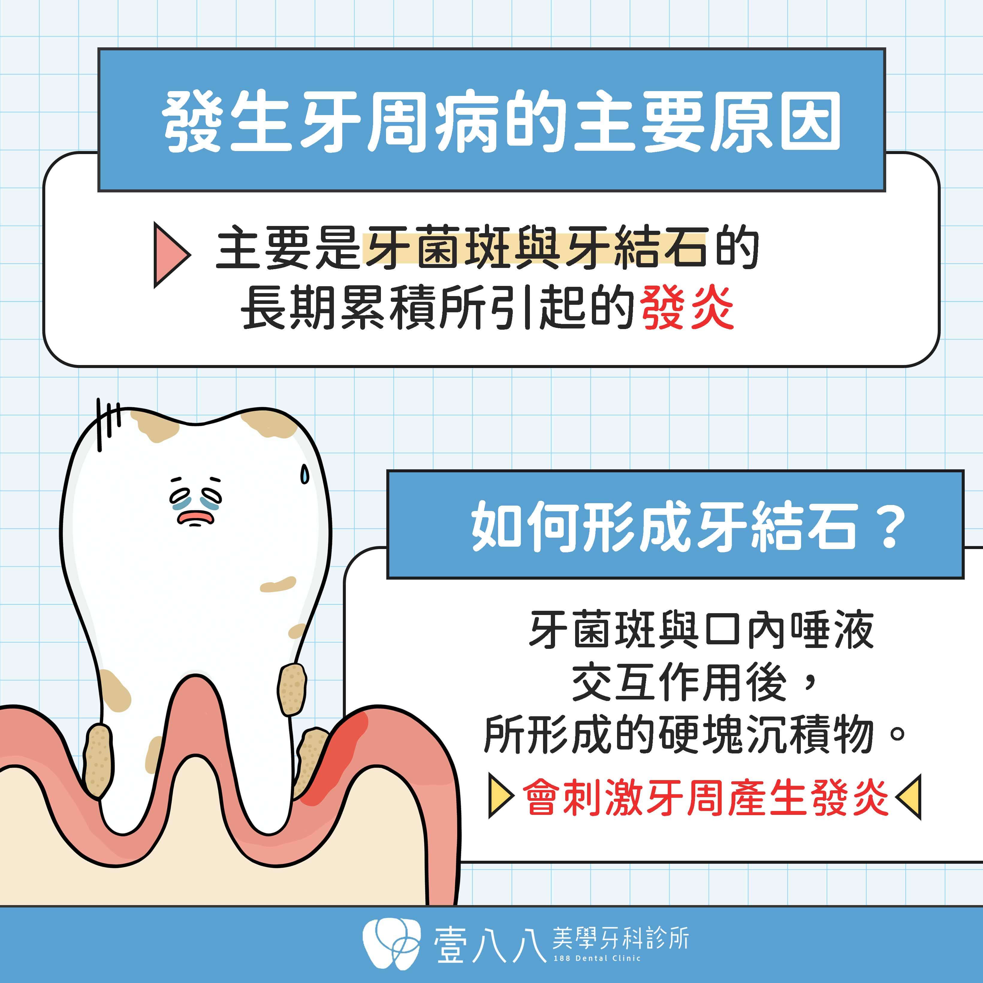 牙周病網頁 為什麼會有牙周病