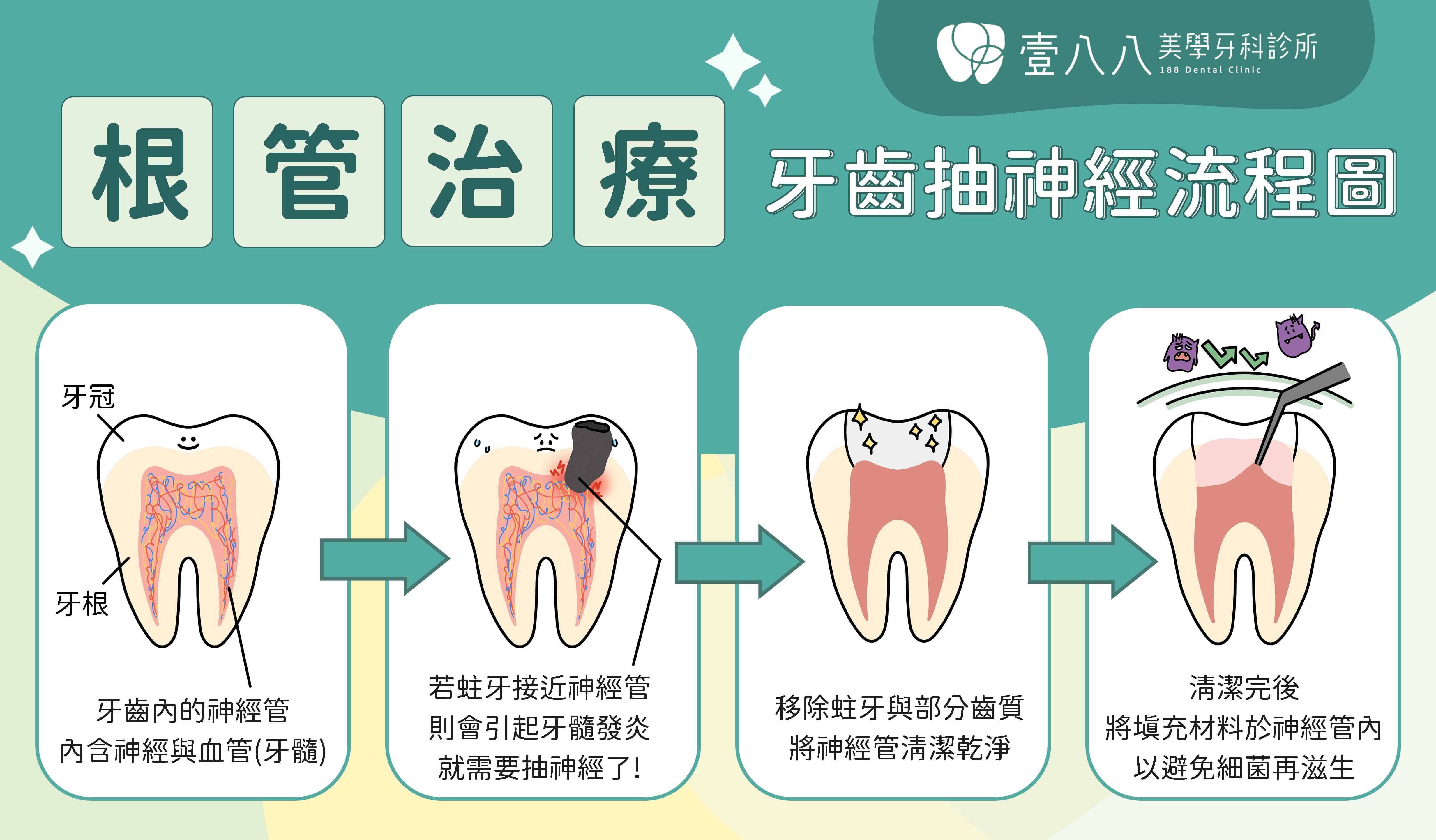 根管治療流程圖